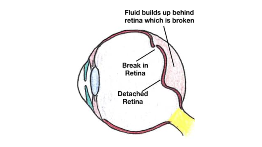 rheg retina